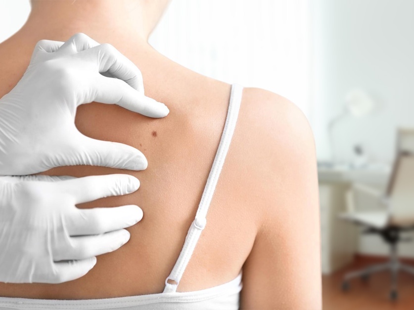 Kožní ordinace - MUDr. Radovan Trtil